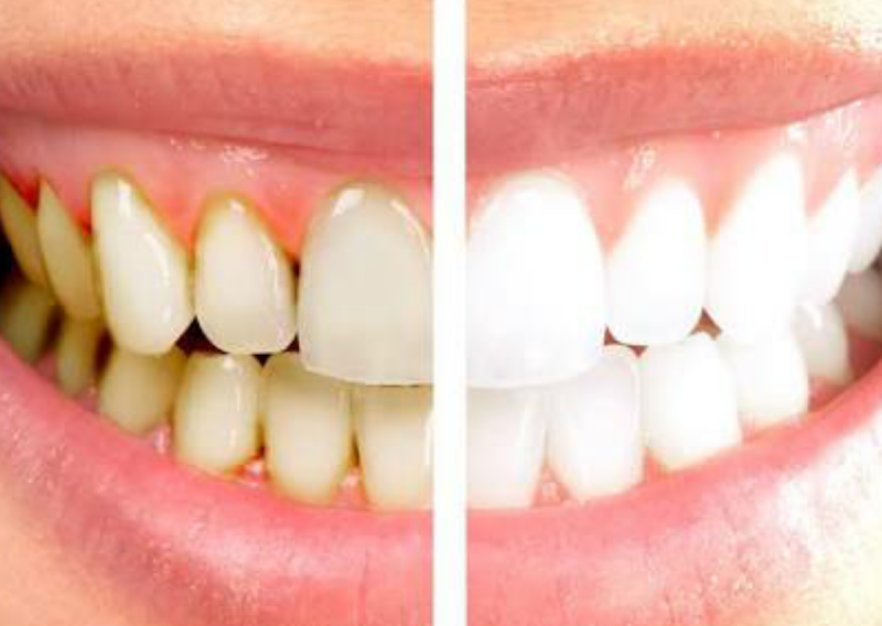 Foto 3 de Dra Patricia Q Garcia - Clínica Sky Odontologia