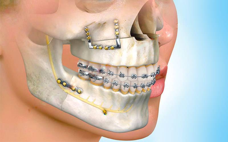 Foto 2 de Dra Patricia Schiavinato Ortodontia
