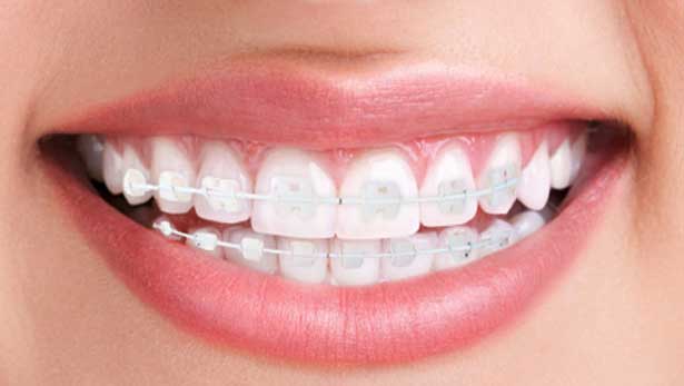 Foto 3 de Dra Patricia Schiavinato Ortodontia