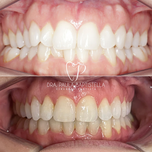 Foto 2 de Dra. Paula Baptistella de Lima | Dentista