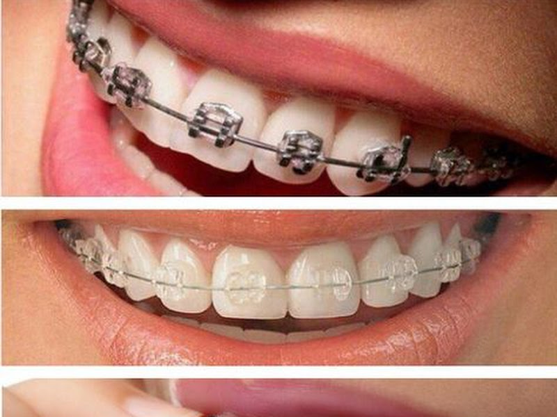 Foto 6 de Dra. Paula Cordeiro - Dentista