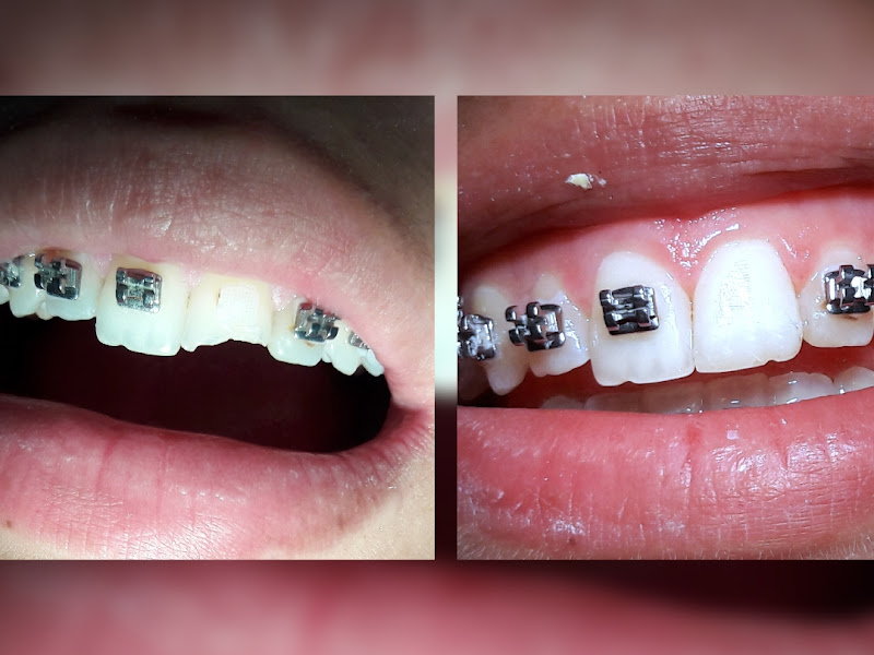 Foto 8 de Dra. Paula Cristina Rodrigues – Consultório Odontológico Premium em Campinas