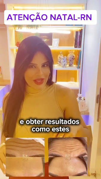 Foto 3 de Dra. Paula de Sá - Harmonização Facial