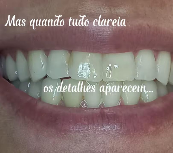 Foto 2 de Dra. Paula Morrell / Clareamento Dental/ Araraquara