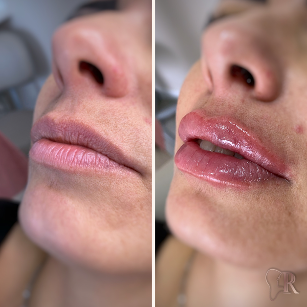 Foto 2 de Dra. Paula Rodrigues - Cirurgiã-dentista e Harmonização Facial