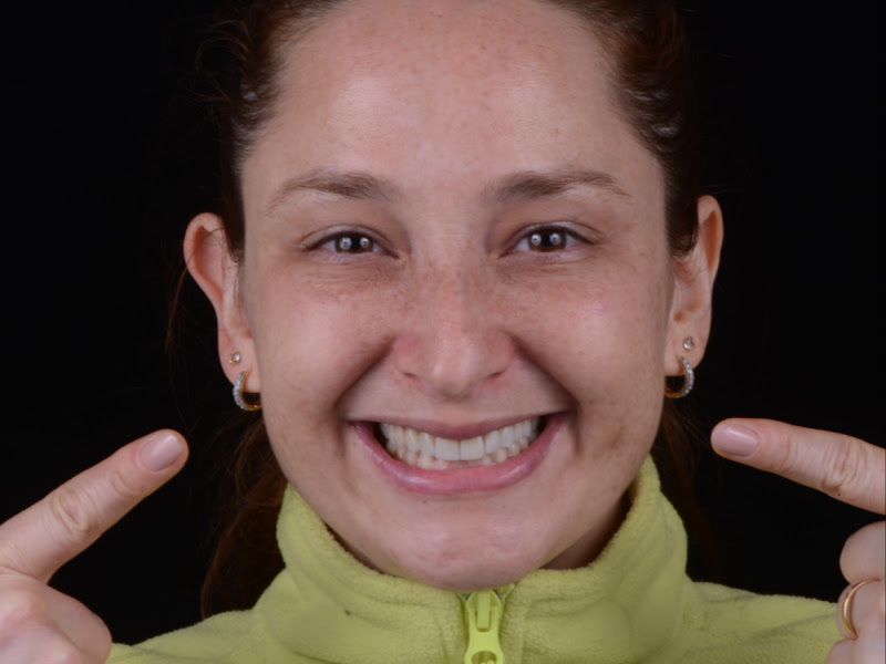 Foto 3 de Dra. Perpétua Freitas - Ortodontista - Invisalign Doctor - Petrópolis - Porto Alegre - RS