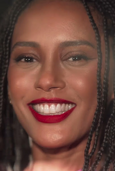 Foto 3 de Dra Poliane Lima -Ortodontia #invisalign