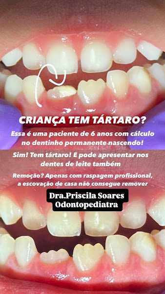Foto 3 de Dra Priscila Soares- Odontopediatra