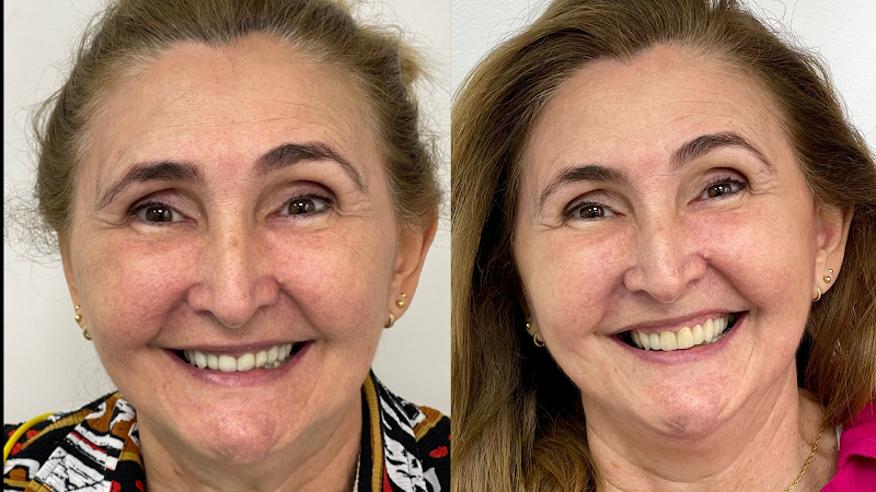 Foto 3 de Dra. Priscila Uehara | Dentista Morumbi | Implante Dentário | Periodontia | Sedação