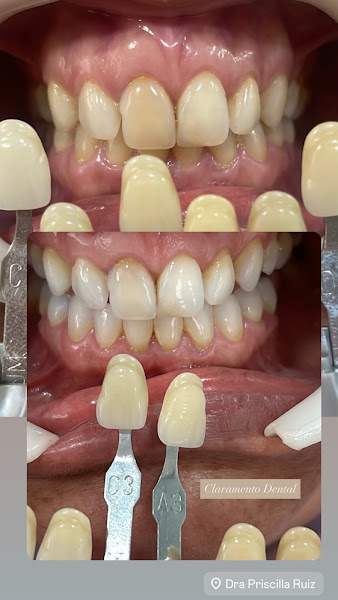 Foto 2 de Dra. Priscilla Ruiz Odontologia e Harmonização Orofacial