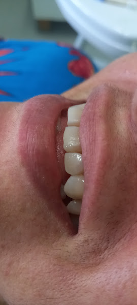 Foto 2 de Dra Pryscila Simplício Odontologia