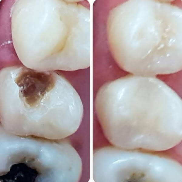 Foto 3 de Dra Pryscila Simplício Odontologia