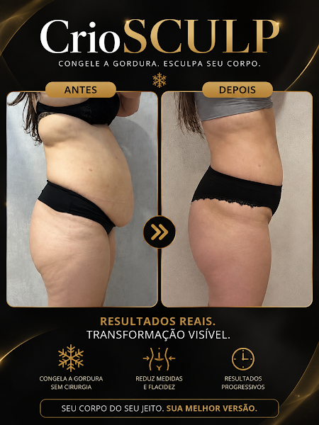 Foto 2 de Dra Quetlei Caboi | Estética Avançada | Harmonização