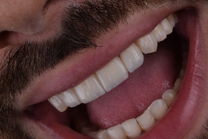 Foto 3 de Dra Rafaela Andrade - Cirurgiã-dentista