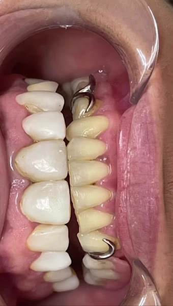 Foto 4 de Dra. Rafaela Andrade - Dentista Mossoró