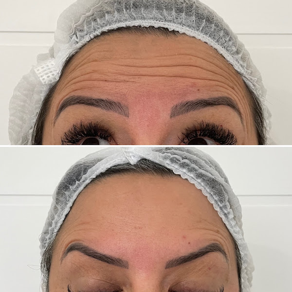 Foto 2 de Dra. Rafaela Bastos - Estética Avançada