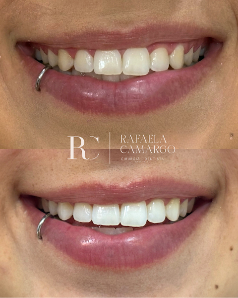 Foto 3 de Dra. Rafaela Camargo - Dentista