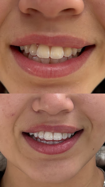 Foto 2 de Dra. Rafaela Estevão - Cirurgiã Dentista
