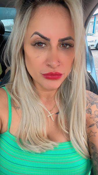 Foto 3 de Dra Rafaela Martins | Harmonização Facial