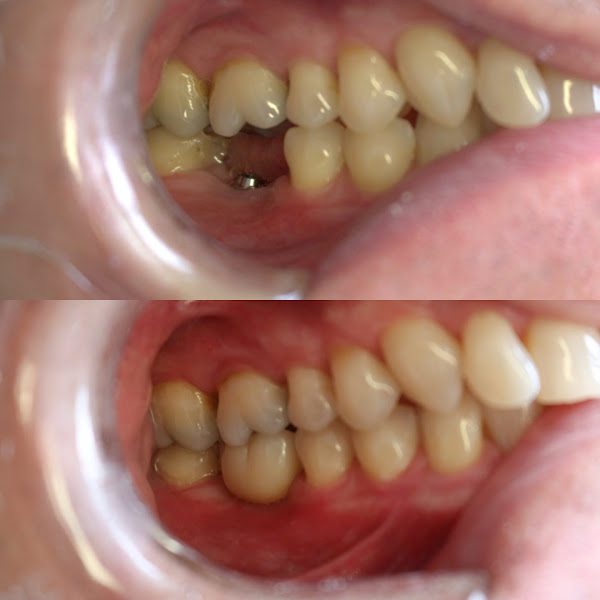 Foto 3 de Dra Rafaela Mazim – Reabilitação Oral e Estética