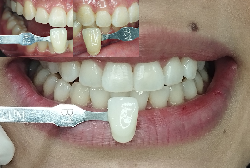 Foto 2 de Dra. Rafaela Muniz/Cirurgiã-Dentista