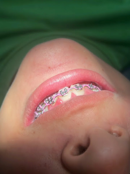 Foto 2 de Dra. Rafaela Oliveira - RO odontologia