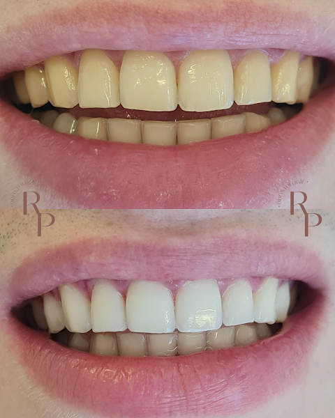 Foto 3 de Dra. Rafaela Pires | Harmonização Orofacial
