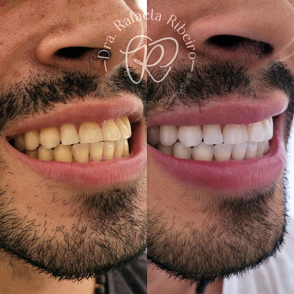 Foto 2 de Dra. Rafaela Ribeiro | Odontologia