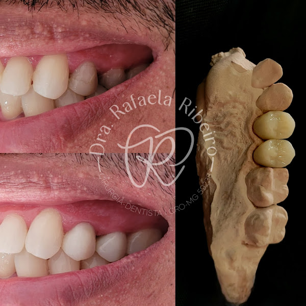 Foto 3 de Dra. Rafaela Ribeiro | Odontologia