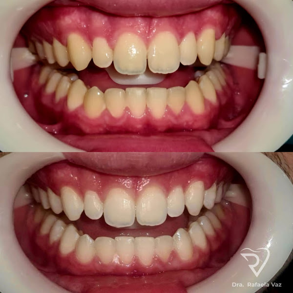 Foto 2 de Dra Rafaela Vaz - Dentista no Hugo Lange