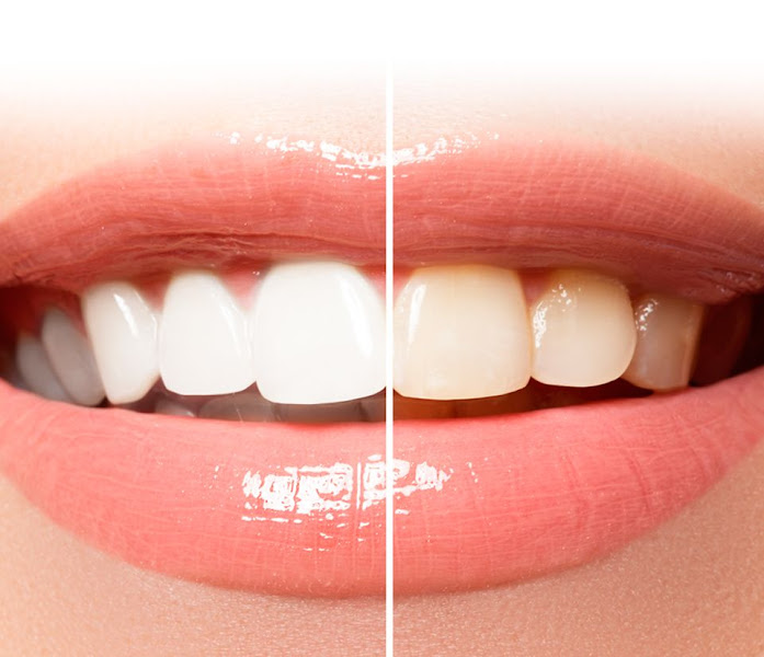 Foto 3 de Dra. Rafaella Duarte Odontologia Especializada