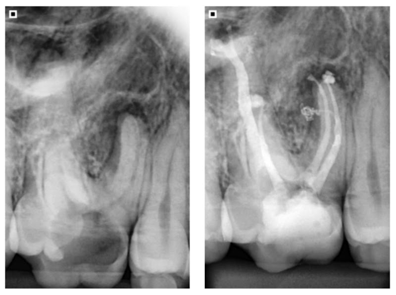 Foto 3 de Dra. Rafaelli Cezar - Dentista e Tratamento de Canal