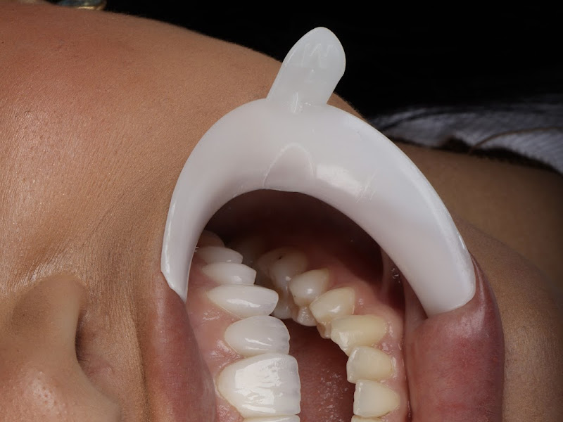 Foto 9 de Dra. Rafaelli Cezar - Dentista e Tratamento de Canal