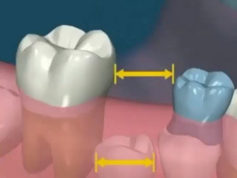 Foto 3 de Dra. Rainez Rocha - Odontologia Especializada