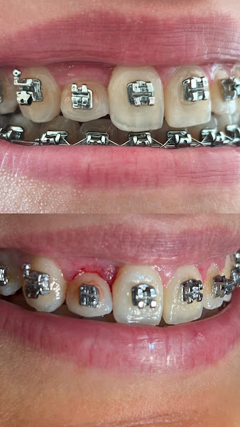 Foto de Dra Raízza Cardoso - Dentista Periodontista