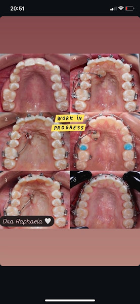 Foto 2 de Dra. Raphaela Oliveira - Dentista - Ortodontista