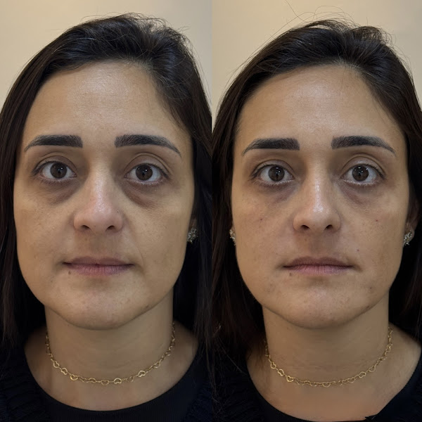 Foto 3 de Dra. Raphaela Thomazi ◇ Harmonização Orofacial