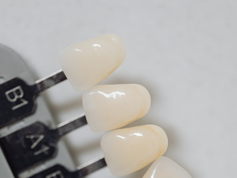 Foto 7 de Dra. Raphaella Postorivo - Odontologia