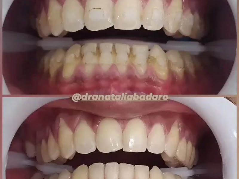 Foto 3 de Dra.Raquel Balbi - Odontologia Vila Valqueire RJ