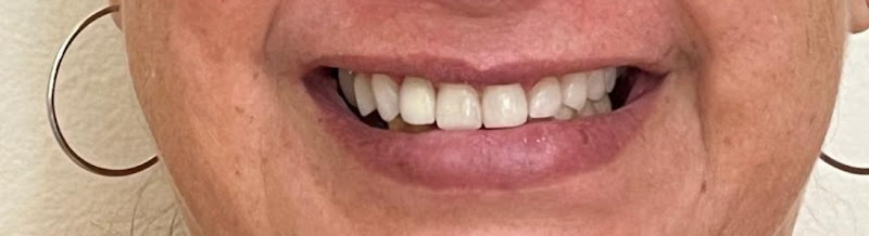 Foto 2 de Dra. Raquel - Odontologia Estética | São Rafael