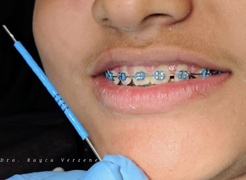 Foto 2 de Dra Rayça Verzene Santiago Tavares