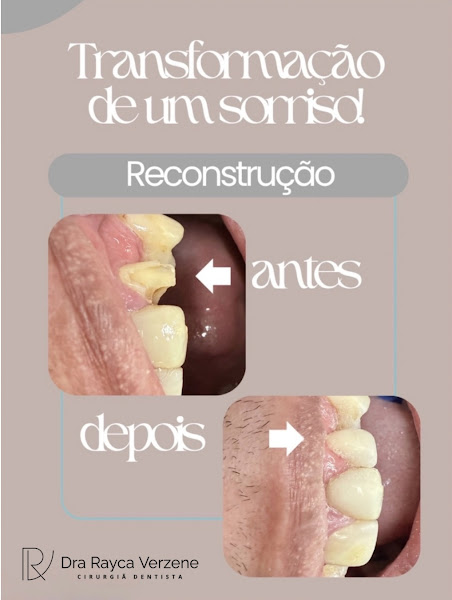 Foto 3 de Dra Rayça Verzene Santiago Tavares