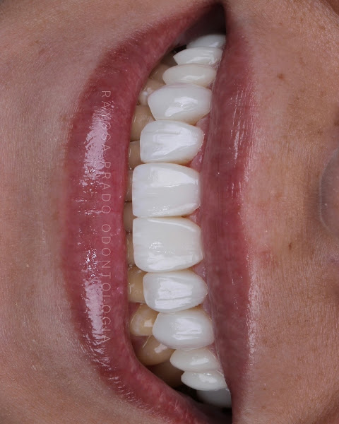 Foto 3 de Dra Rayssa Prado - Lentes e Facetas