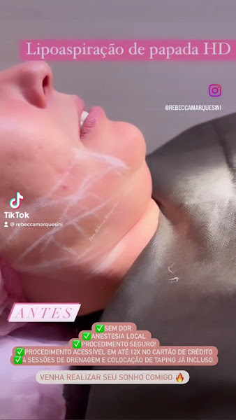 Foto 2 de Dra. Rebecca Marquesini