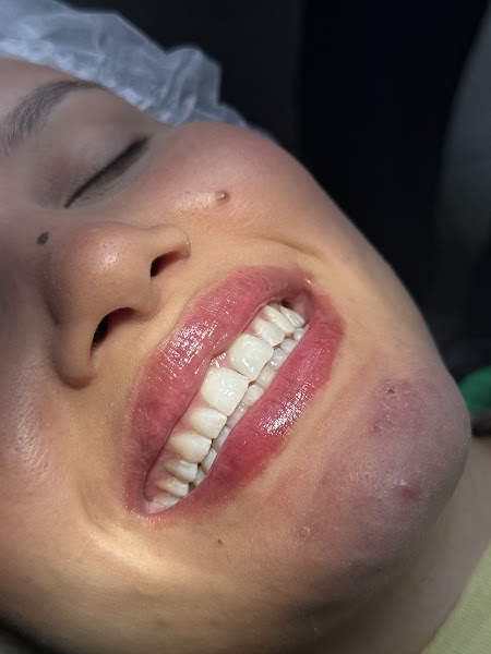 Foto 2 de Dra. Rebecca Mattos Cirurgiã Dentista