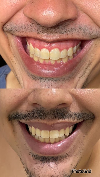 Foto 3 de Dra. Regivania Costa - Dentista em Sobral - Harmonização / Prótese Dental