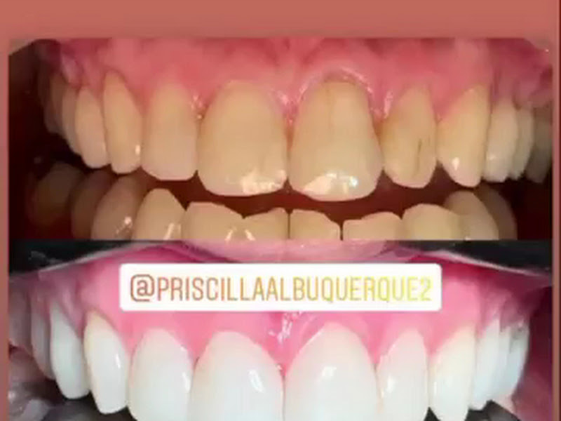 Foto 8 de Dra. Regivania Costa - Dentista em Sobral - Harmonização / Prótese Dental