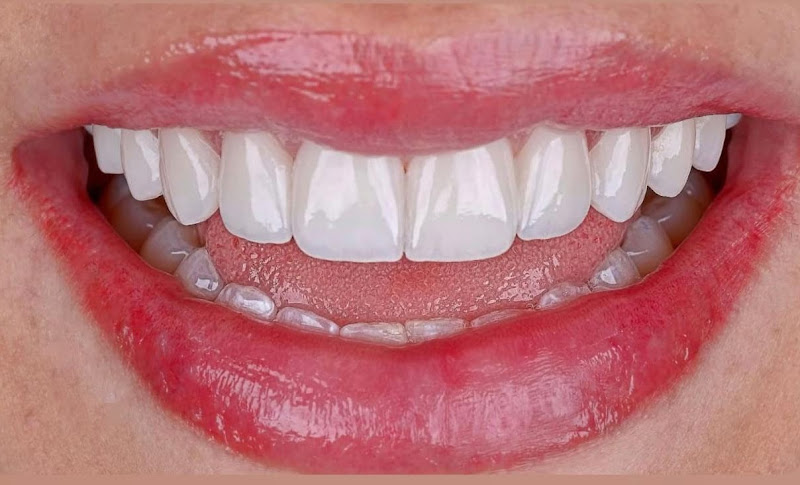 Foto 2 de Dra. Regla Odontologia Estética | Lentes de contato Dental