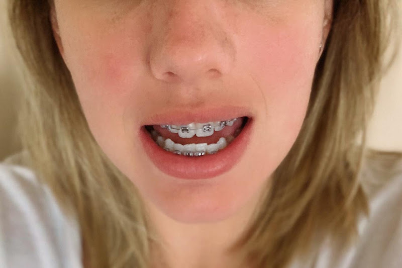 Foto 2 de Dra. Renata Barros - Cirurgiã e Ortodontista no Recreio dos Bandeirantes RJ