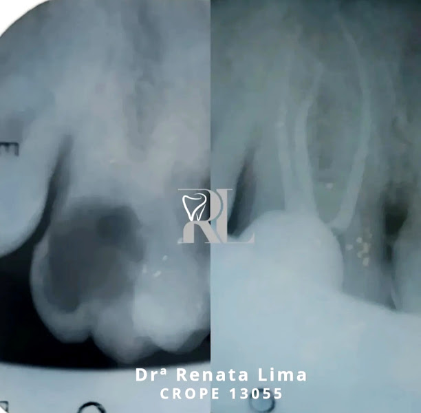 Foto 3 de DRA RENATA LIMA - RL Odontologia